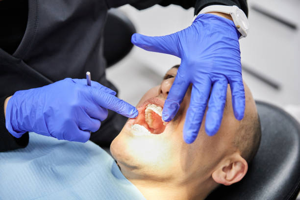 Best Emergency Broken Tooth Repair in Donaldsonville, LA