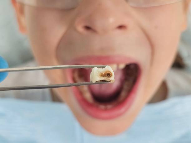 Best Walk-In Emergency Dentist in Donaldsonville, LA